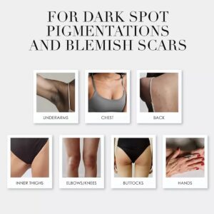 Use Kaia Naturals Kojic Acid Body Bar to fade dark spot pigmentation and blemish scars - for underarms, chest, back, inner thighs, buttocks, elbows and knees, and hands.