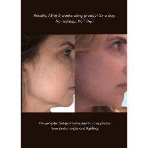 Shop Maya Chia Advanced Response Complex, a face and neck cream to firm and rejuvenate.