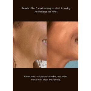 Shop Maya Chia The Advanced Response Complex Treatment, an anti-aging face and neck cream to smooth, firm and brighten maturing skin.