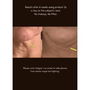 Maya Chia The Advanced Response Complex is an anti-aging face and neck cream designed to soft soften line and firm skin.