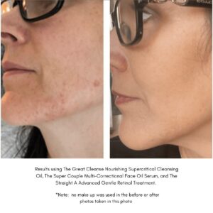 Shop Maya Chia skin care for a smoother, radiant complexion that is more clear and even.