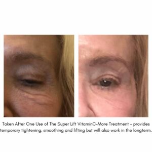 Shop Maya Chia The Super Lift Concentrated Vitamin C-More Serum at Inspire Beauty.