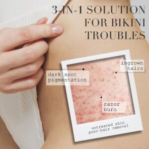 Shop Kaia Naturals Bikini Bright, a milky treatment to brighten dark spot pigmentation, soothe irritation and redness and manage ingrown hairs.