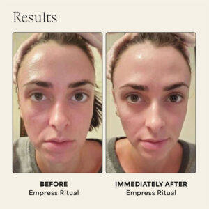 Use Wildling Empress Stone gua sha to lift, tone and de-puff.