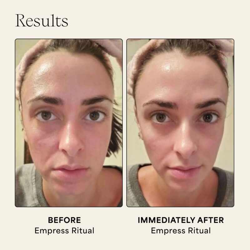 Use Wildling Empress Stone gua sha to lift, tone and de-puff.