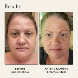 Wildling Empress Collection gua sha ritual set visibly lifts, firms and smooths skin.