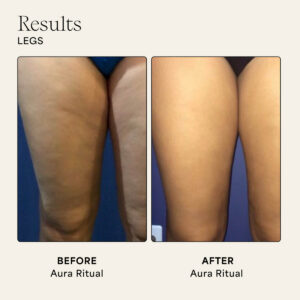 Results from Wildling Aura body gua sha ritual.