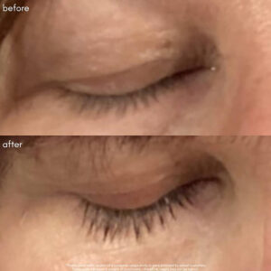 Maya Chia Power Fol Eyelash & Eyebrow Treatment enhance volume and length of eyelashes.