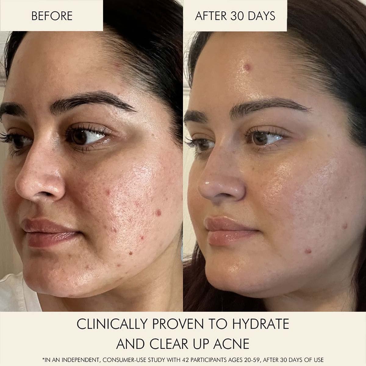 Shop Mara Beauty Clear Skin Mineral Milk at Inspire Beauty a clarifying serum for clearer, blemish-free skin.