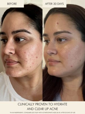 MARA Beauty Clear Skin Mineral Milk is a clarifying serum to disolve surface buildup and keep skin clear.