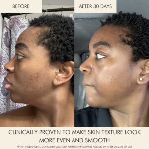 Used daily, Mara Clear Skin Mineral Milk helps to decongest clogged pores, brighten and fade acne marks, and promotes a clear complexion.