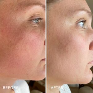 Three Ships Skin Hero Calendula + 2% Bakuchiol Bio-Retinol Serum is a multi-tasking serum to firm and even out skin tone.