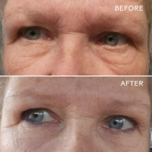 Three Ships Eye Hero Bio-Retinol Smoothing Eye Cream firms and smooths lines and wrinkles.