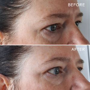 Three Ships Eye Hero Bio-Retinol Smoothing Eye Cream for smoothing fine lines and wrinkles.