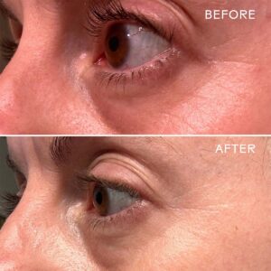 Three Ships Eye Hero Bio-Retinol Smoothing Eye Cream firms and smooths the under eye area.