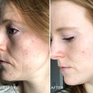 Three Ships Refresh Papaya + Salicylic Acid Foaming Cleanser removes makeup and excess oil while unclogging congested pores, helping to minimize the appearance of breakouts.