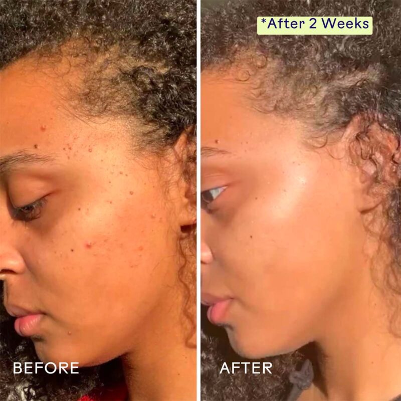 Three Ships Superfruit Lactic + Multifruit 8% AHA Exfoliating Mask smooths, brightens and fade dark spots and blemishes.