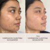 Sachi Skin Complexion Clarifying Accelerator for acne prone skin.