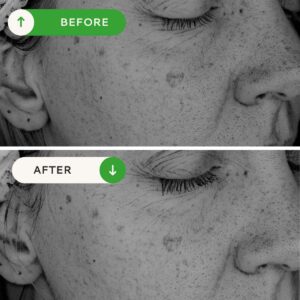 VOTARY Brightening Hyaluronic Serum reduces discolouration and improves skin's evenness and clarity.