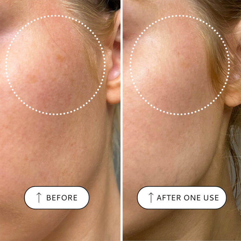 VOTARY Sensitive Resurfacing Peel reveals younger-looking, fresher skin
