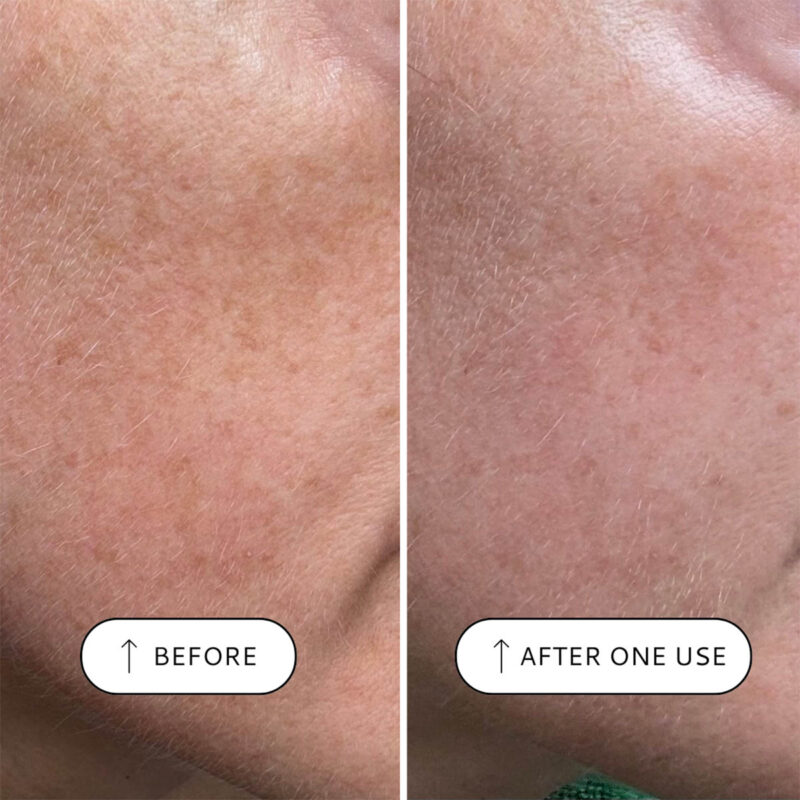 VOTARY Sensitive Resurfacing Peel minimising the irritation often associated with high performance peels.