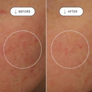 VOTARY Super Seed Serum is a soothing peptide serum to reduce redness, increase moisture levels and soften lines and wrinkles.