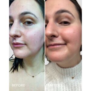 Use Three Ships Boost 49% Rosehip Oil Serum to soften, plump and brighten skin.