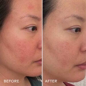 Three Ships Replenish Barrier Repair Serum is great for strengthening and soothing sensitive and compromised skin.