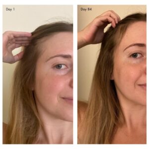 Agent Nateru Holi (Growth) 84 is an intensive, leave-in scalp treatment that stimulates growth, minimizes shedding, and nurtures the scalp for transformative results.