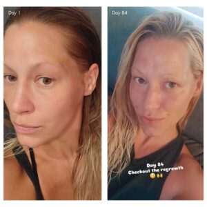 Crafted with care, Holi (Growth) 84 combines scientifically proven ingredients with botanical extracts to create a clean, leave-in highly effective hair growth formula without an oily residue.