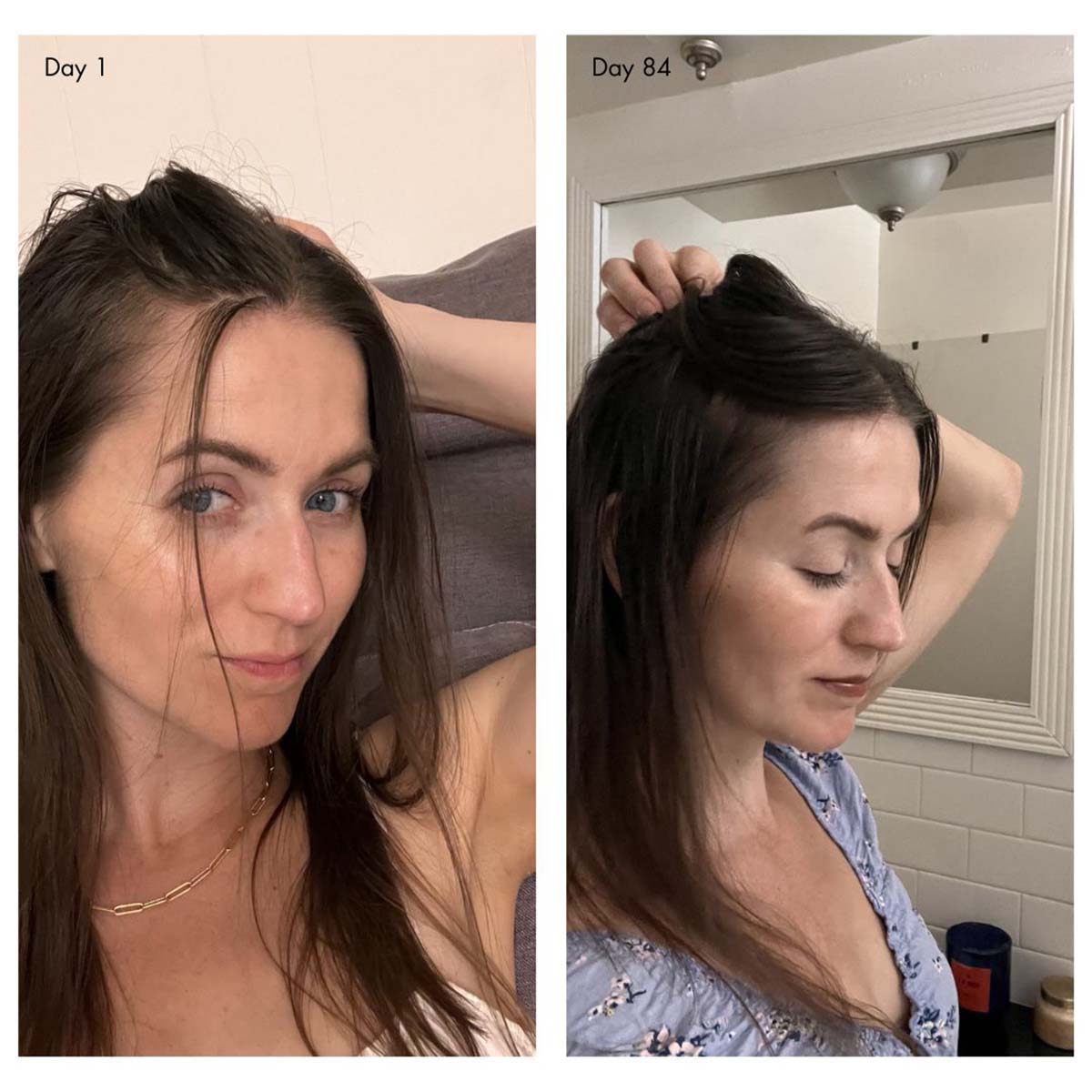 Agent Nateur Holi (Growth) 84 is the secret to thicker, fuller, and healthier hair in just 84 days.