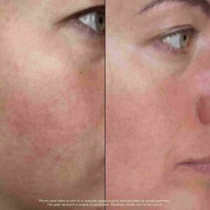 Maya Chia The Meringue Melt Regenerating Skin Softening Cleanser visibly smooths, brightens, and resurfaces the skin without disrupting the skin barrier.