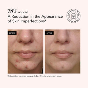 Odacité Salicylic + Hyaluronic Acid Clarifying Serum available at Inspire Beauty.