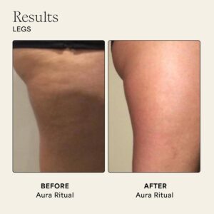 With regular use, Wildling Aura PLatinum gua sha helps firm, tone and smooth the appearance of cellulite.