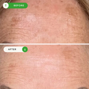 VOTARY Vitamin C Glow Serum is a Vitamin C and Alpha Arbutin brightening serum to combat dullness and uneven skin tone.