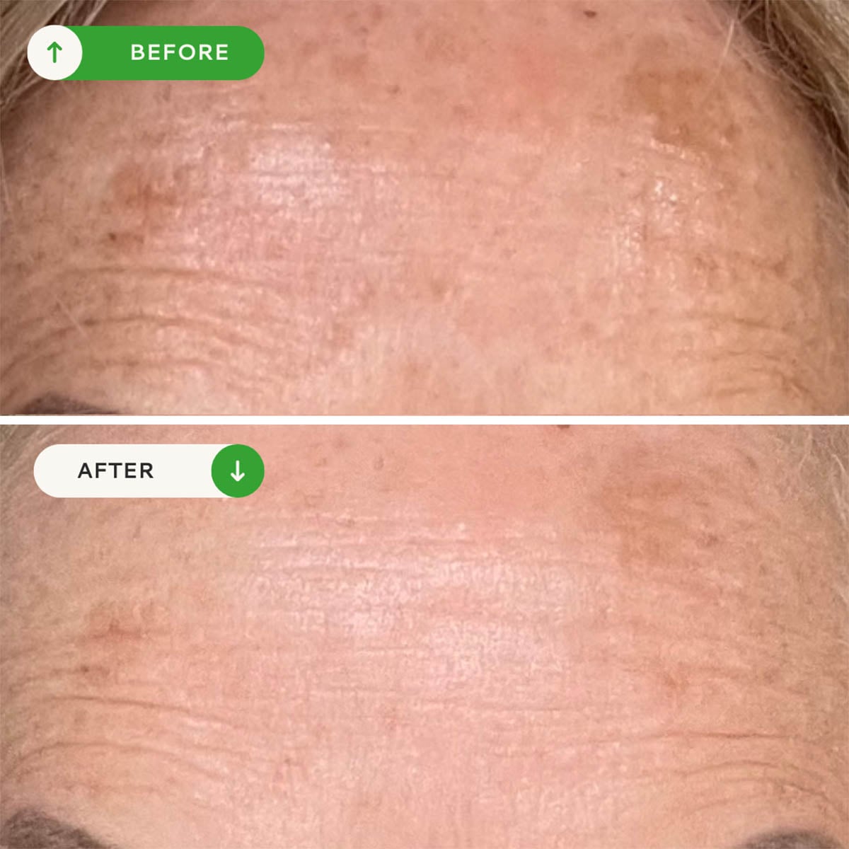 VOTARY Vitamin C Glow Serum is a Vitamin C and Alpha Arbutin brightening serum to combat dullness and uneven skin tone.