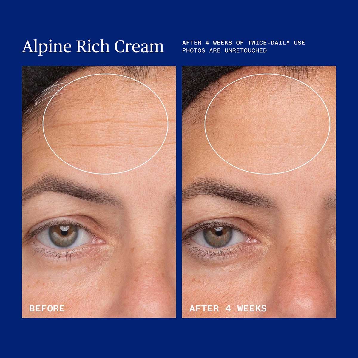 Ursa Major Alpine Rich Cream helps restores skin’s natural barrier to help seal in hydration, soothe that dry, tight feeling, and shield skin from everyday stressors.